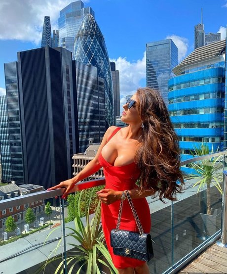 Misskayleighrosedematos