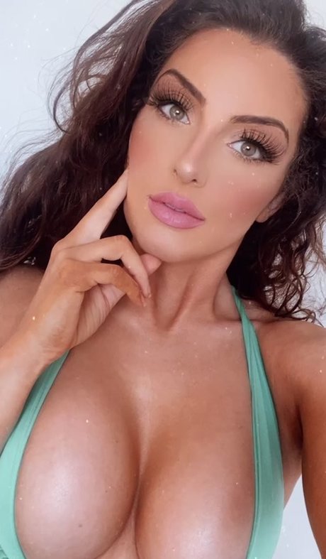 Misskayleighrosedematos