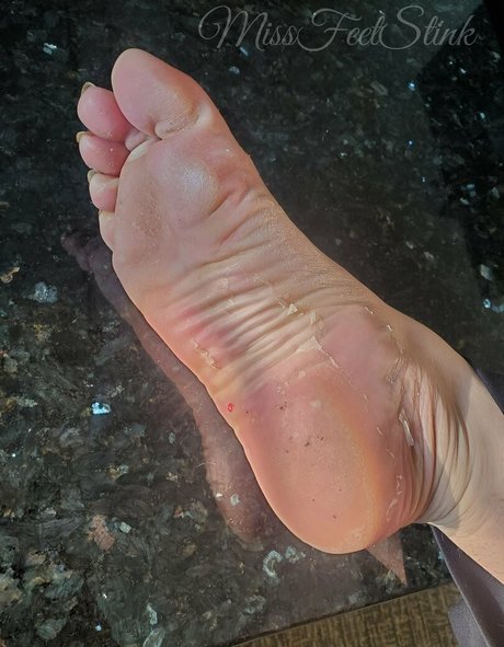 Missfeetstinkvip