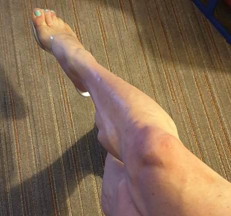 Laceysmuscularcalves