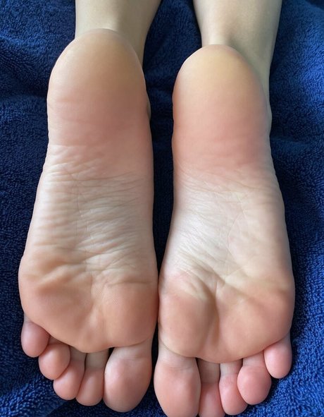 Myposedtoes