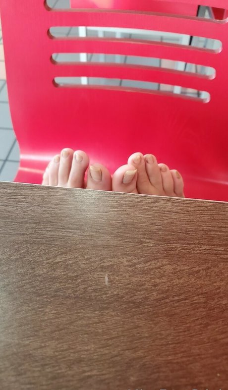 Missfeetstink