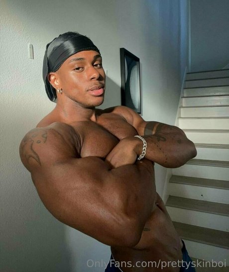 Prettyskinboi