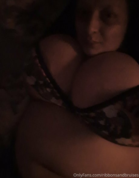 Ribbonsandbruises